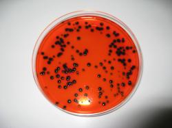 Image of Salmonella typhimurium on XLD Agar