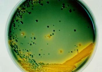 Image of Vibrio cholerae and Vibrio parahaemolyticus on TCBS agar